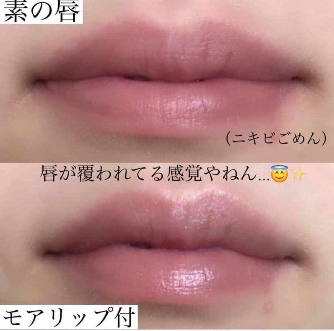 日本 資生堂SHISEIDO MOILIP 修護潤唇膏（8g）